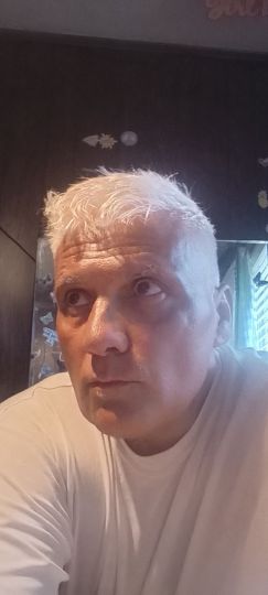 No dye on hair all natural been turning this color all my life well brown to salt and pepper age 17 then around40 almost all silver then around 48 started turning from silver to white and now at she 52 all white but I'm not losing any at all lol